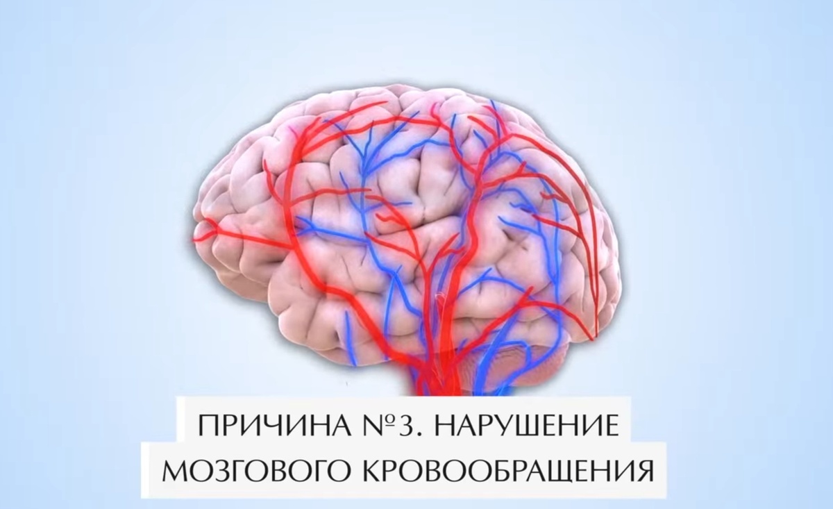 Причина шума в ушах - нарушение мозгового кровообращения