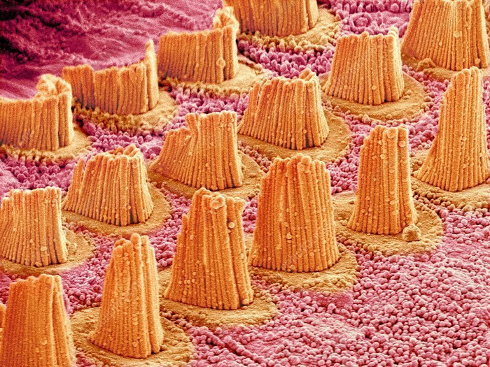 Волосяные клетки внутреннего уха,чем не мегаполис?