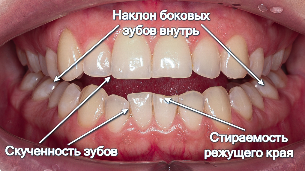 Проблемы, которые беспокоили Елену