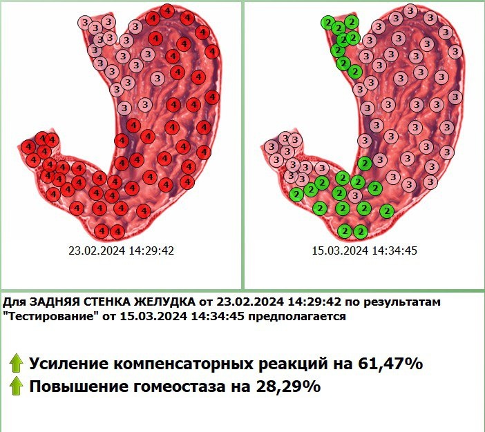 Диагностика с коррекцией состояния в программе Дианел