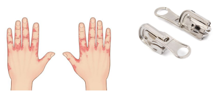 В 99% слачаев никель используется для застежек, молний, пряжек и тп 