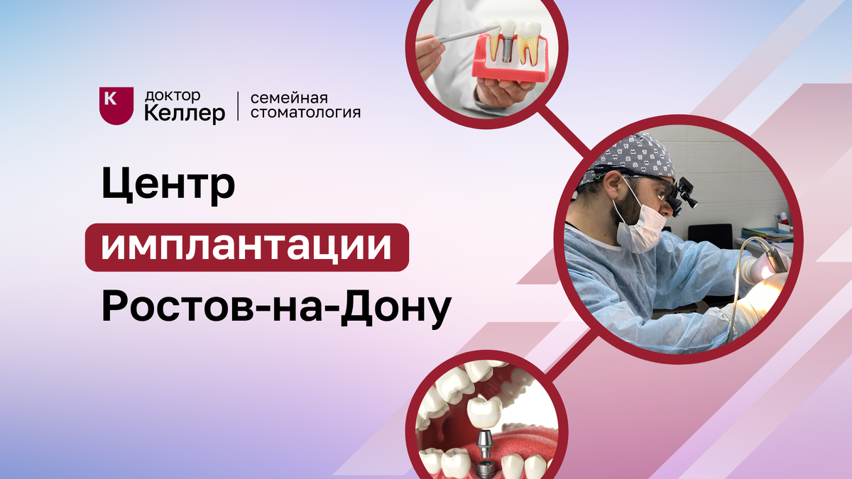 В центре имплантации "Доктор Келлер" мы беремся за сложные случаи и используем методы бережной имплантации.