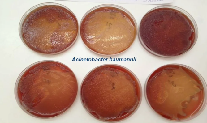фото ФБУН Московский НИИ эпидемиологии и микробиологии имени Г.Н. Габричевского