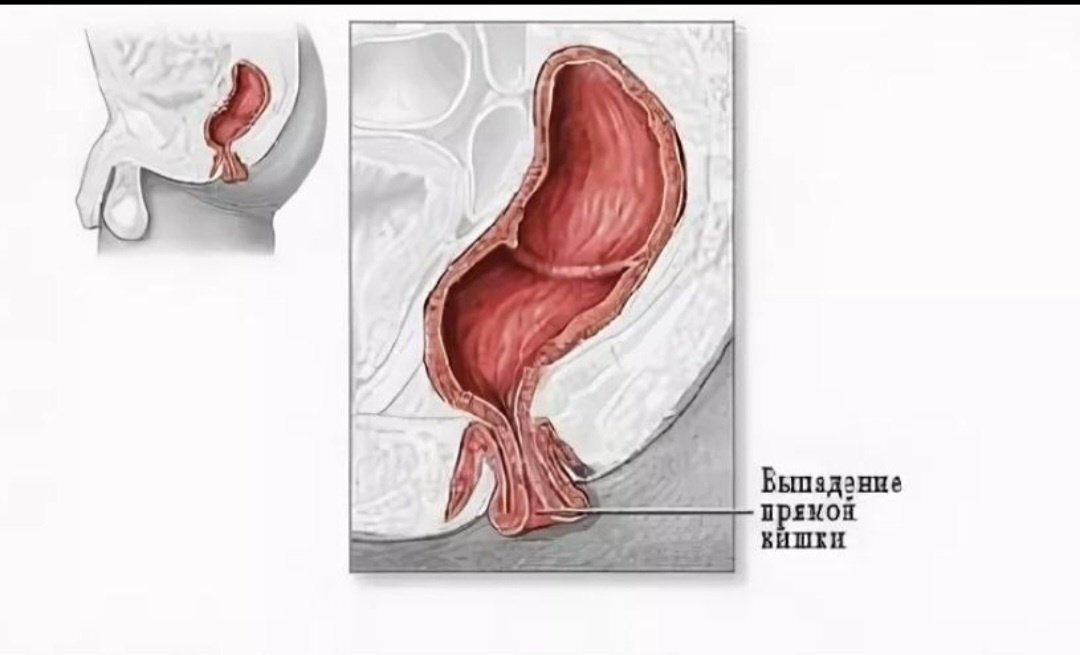 Фото из открытого доступа 