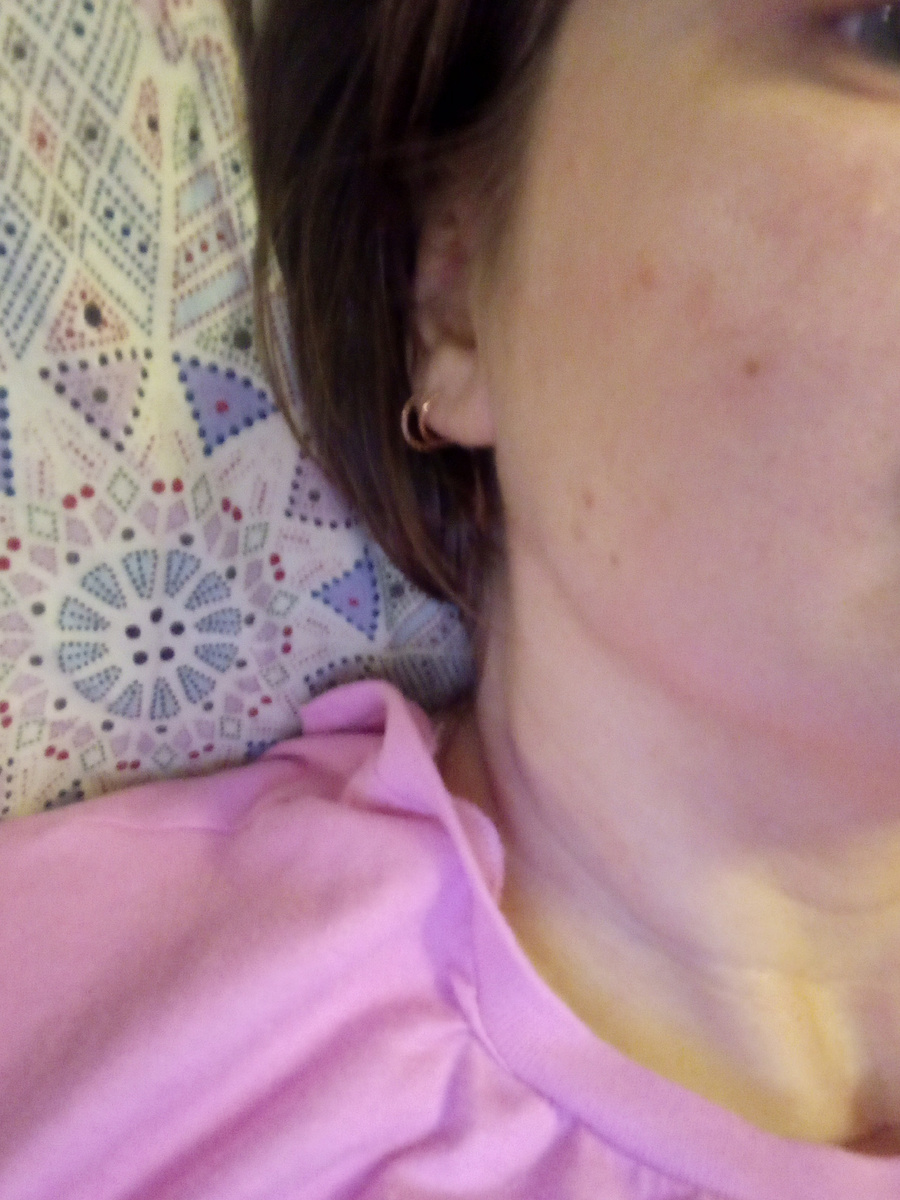 Такие родинки