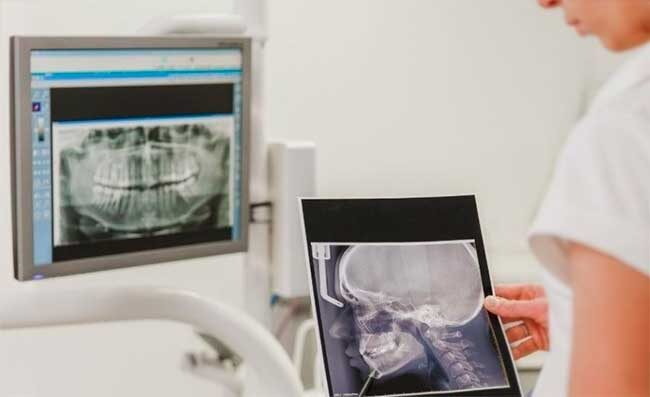 9 вещей, которые вы должны знать о боли в височно-нижнечелюстном суставе