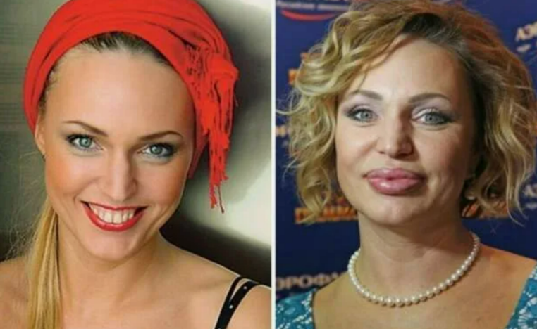 Алла Довлатова в молодости и сейчас