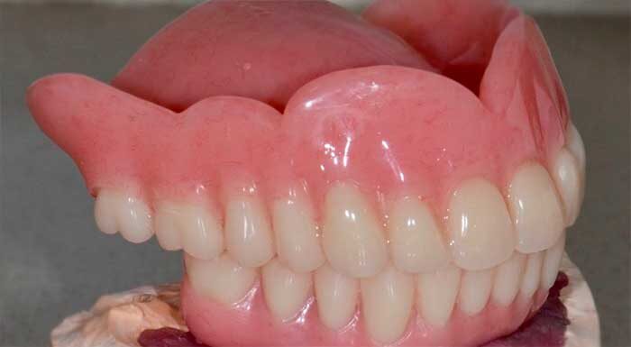 Полные зубные протезы