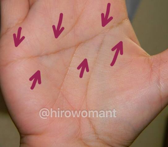 ЕДИНСТВЕННАЯ ПОПЕРЕЧНАЯ ЛАДОННАЯ СКЛАДКА ( Симиан )