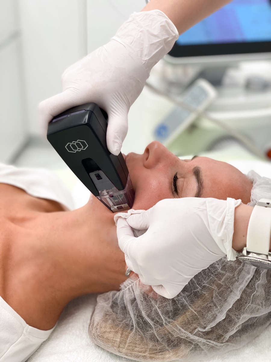 Микроигольчатый РФ-Лифтинг в СПб