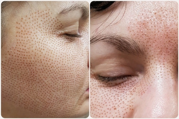 Фото взято из открытых источников