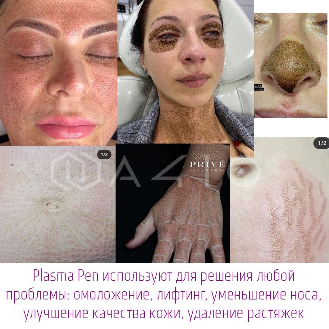 Источник а410