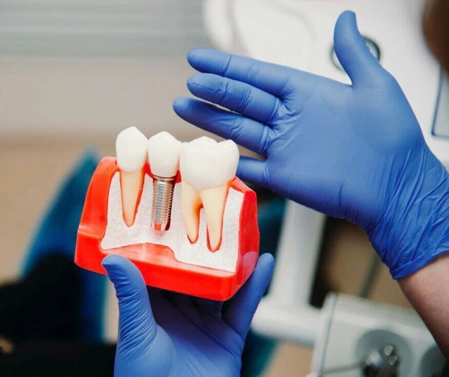 На консультации доктор подробно объяснит все предстоящие этапы