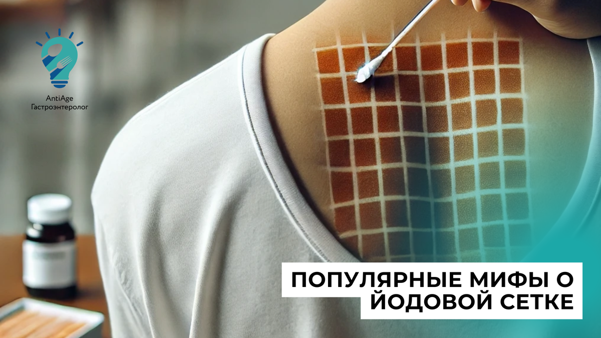 Йодовая сетка