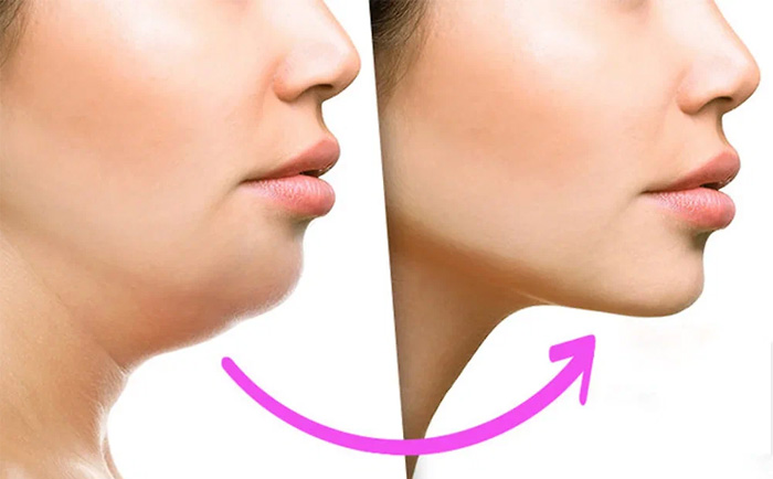 Техника мьюинг для лица