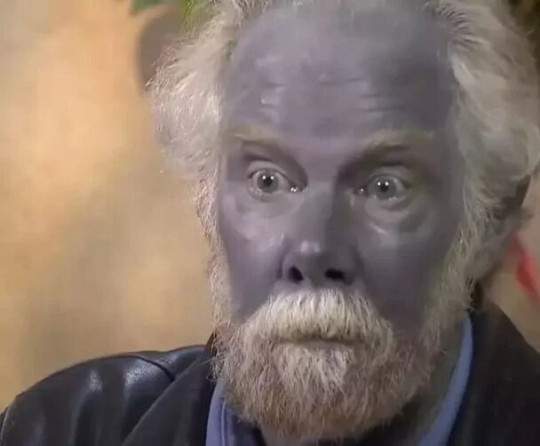 -4