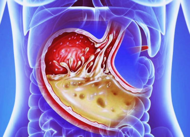 Измененное изоображение для оформления статьи