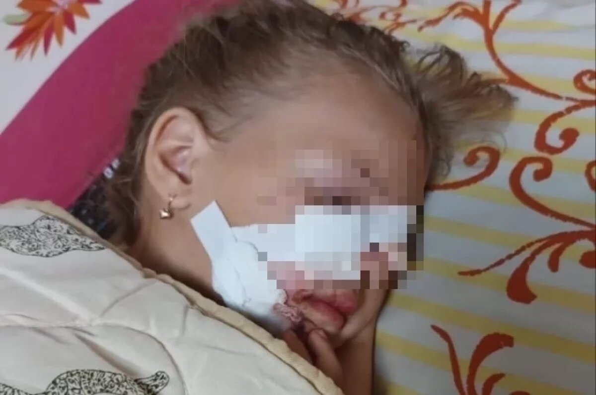    Под Новосибирском накажут соседей, чья собака покалечила 6-летнюю девочку
