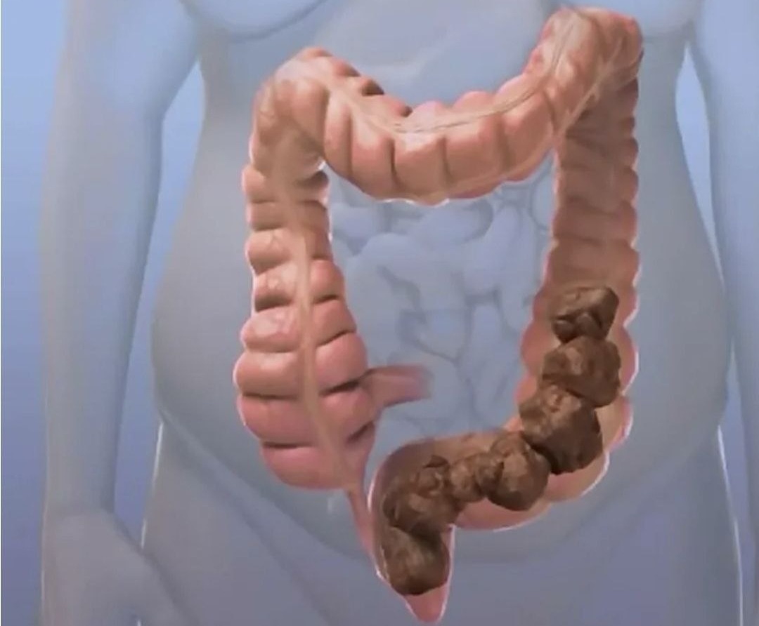 Фото из открытого доступа 