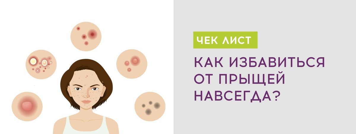 Как избавиться от прыщей навсегда и предотвратить рубцы постакне