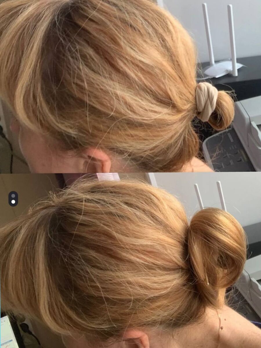 Коллаж до/после с резинкой АМЕРА