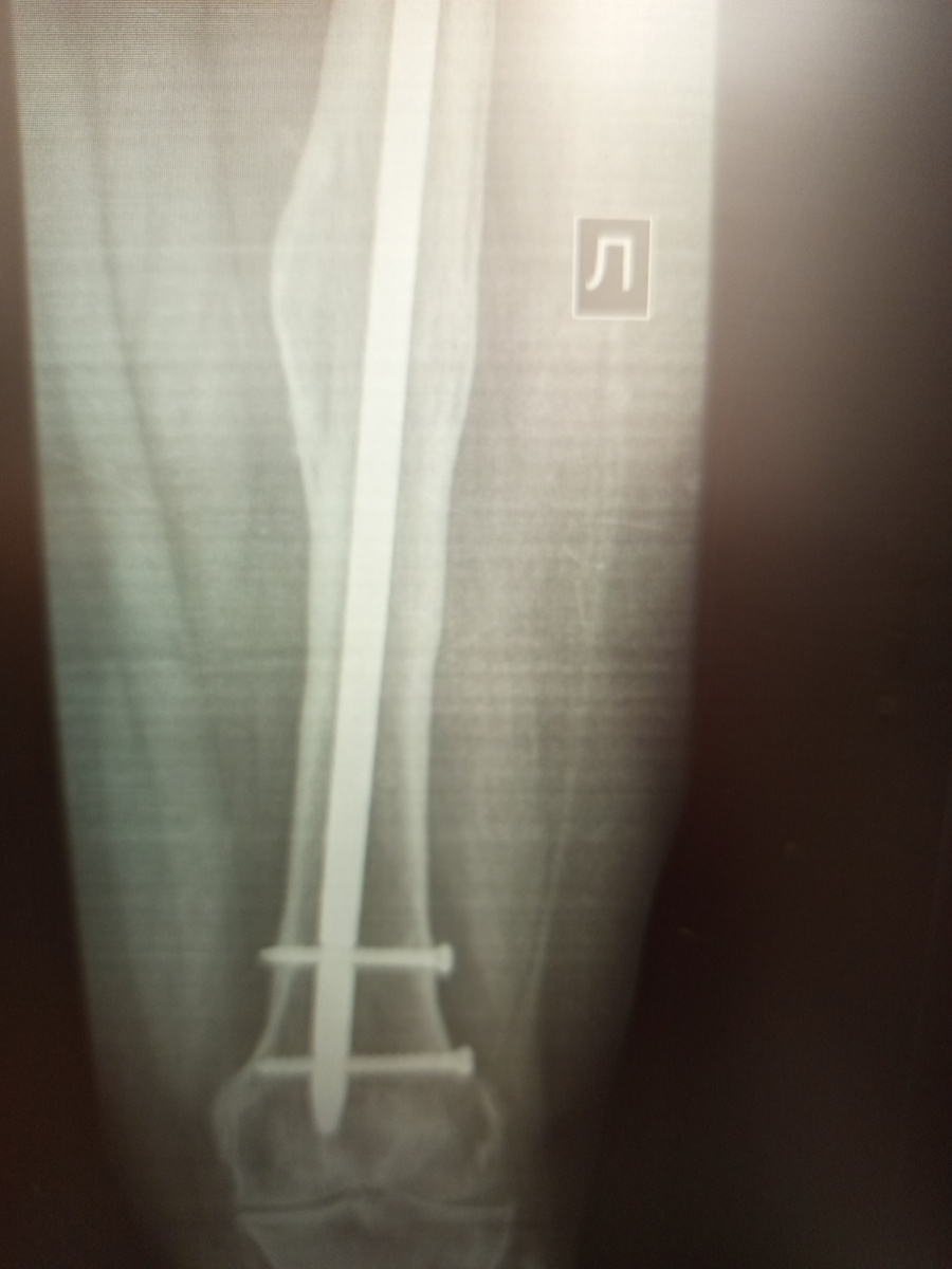 Хорошо так стоит )