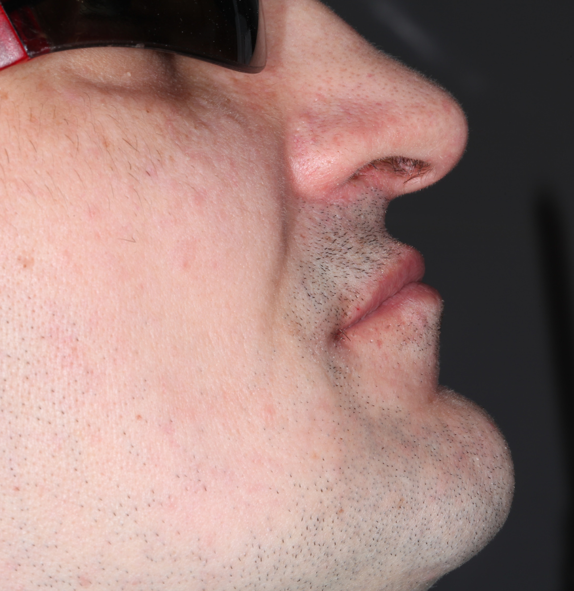 Губы ввалились