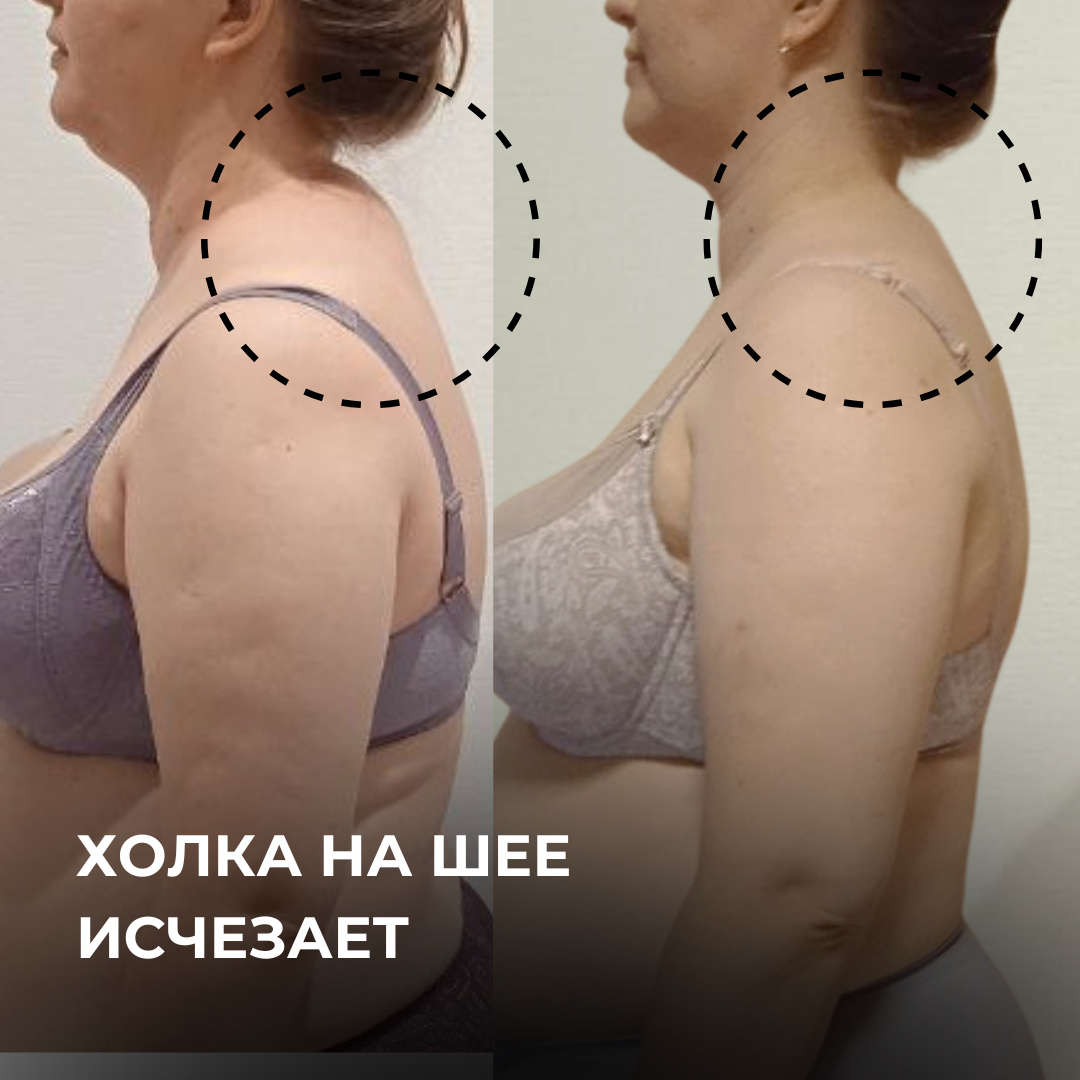 Вот пример работы. Обратите внимание как поднялась грудная клетка.