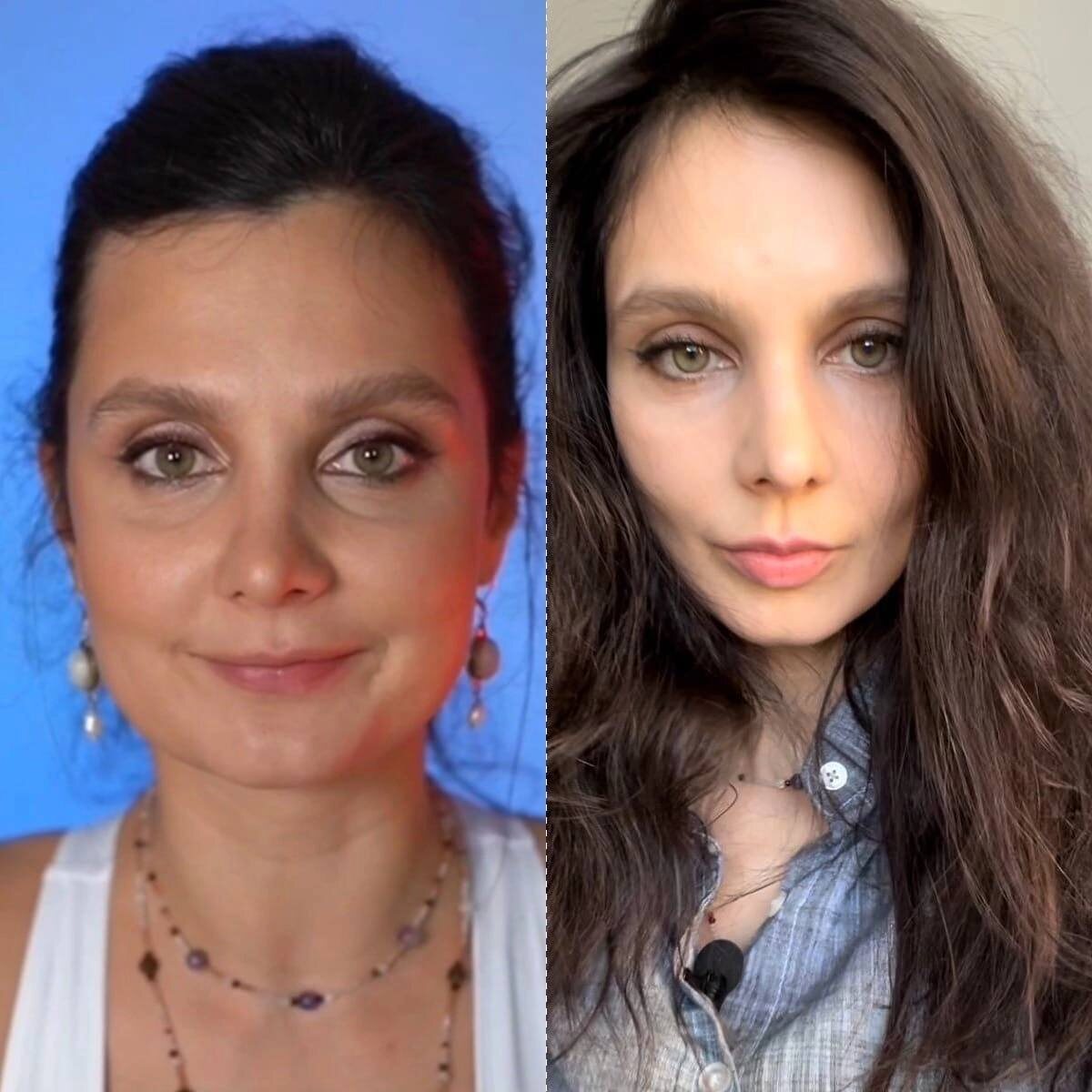 Слева 3,5 года назад справа я сейчас 