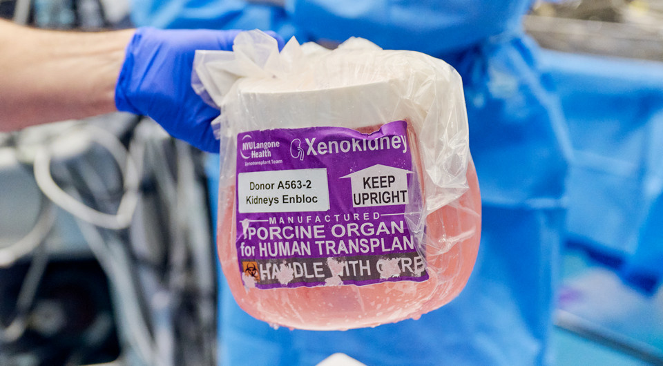   Joe Carrotta for NYU Langone Health