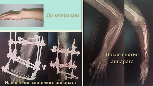    Фото: Министерство здравоохранения Кировской области