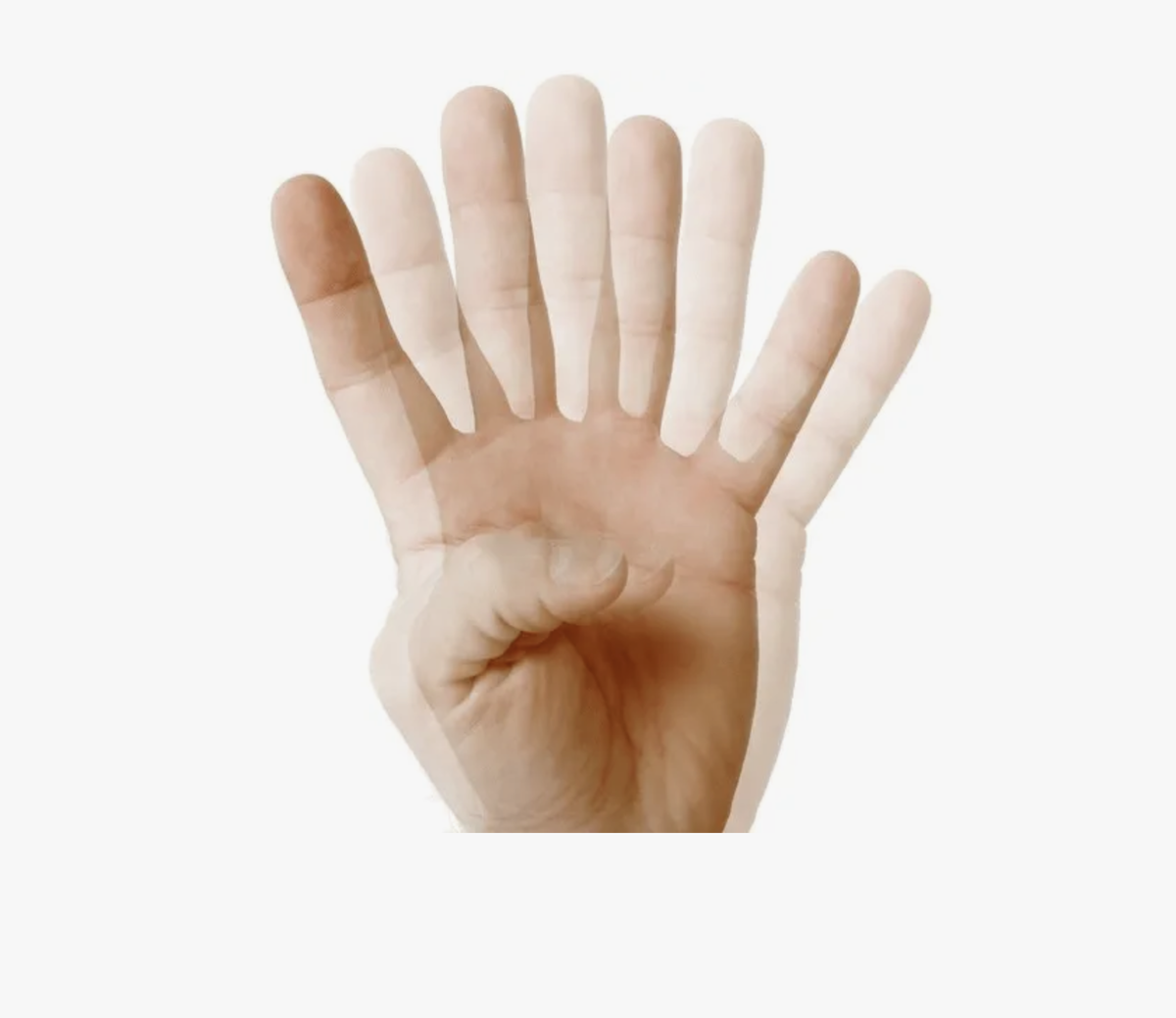 Что видит человек при диплопии - может проявится сразу или через несколько недель после введения ботокса.