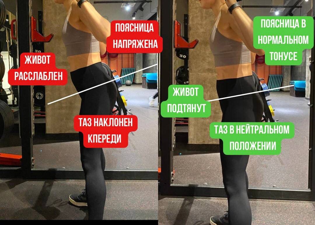 Был гиперлордоз - и нет его