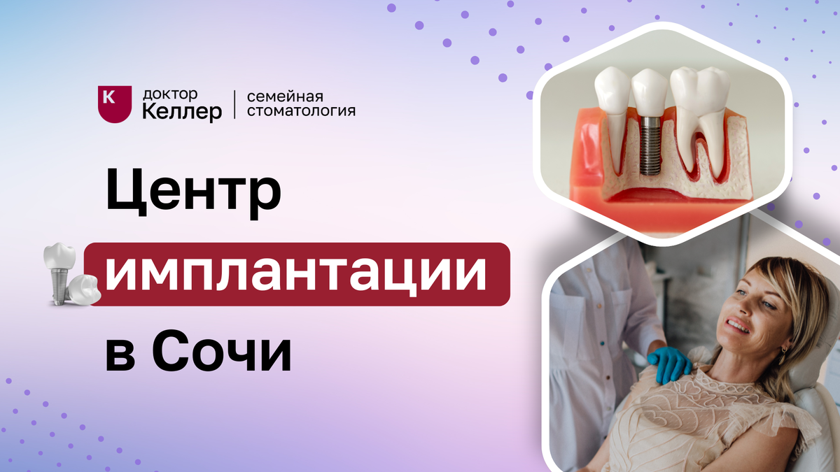 В центре имплантации “Доктор Келлер” Сочи работает команда из 10 хирургов-имплантологов, обладающих общим опытом работы в 133 года. Этот значительный опыт позволяет нам обеспечивать высокий уровень медицинского обслуживания и применять комплексный подход к каждому пациенту. Мы стремимся к тому, чтобы каждый наш пациент получал максимально качественное лечение, основанное на современных методах и технологиях. Наша команда профессионалов готова предложить индивидуальные решения, учитывающие все особенности здоровья и пожелания пациентов.
