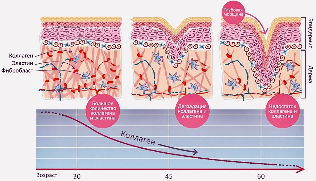 Инволюционные изменения кожи