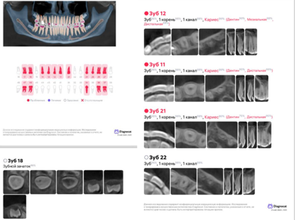 Пример стоматологического отчета с использованием искуственного интеллекта