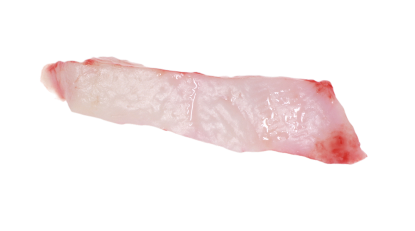 Histological evaluation of healing and revascularization of the subepithelial connective tissue graft R Guiha, S el Khodeiry, L Mota, R Caffesse