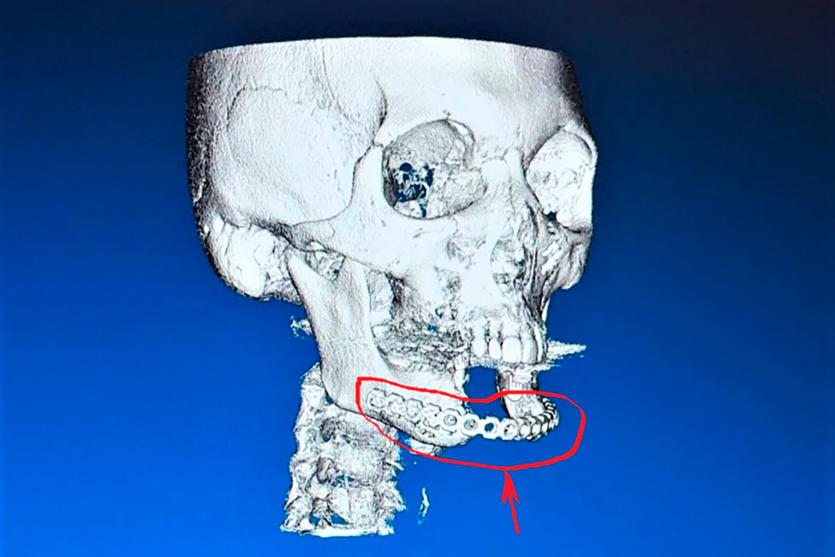Краевая клиническая больница📷3D-модель челюсти