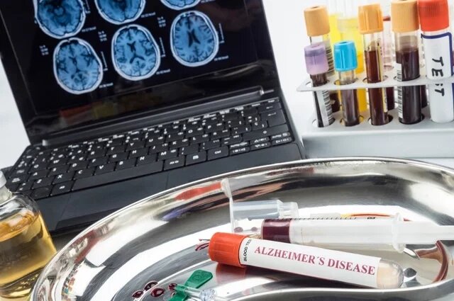 
Бегом от старческого слабоумия. Как диагностировать болезнь Альцгеймера
Подробнее