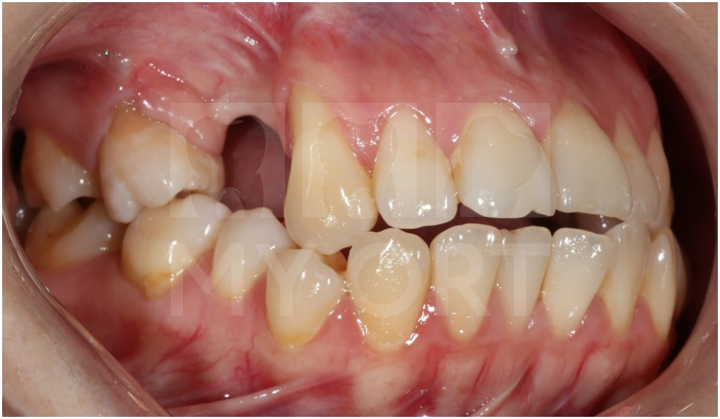 ситуация ДО