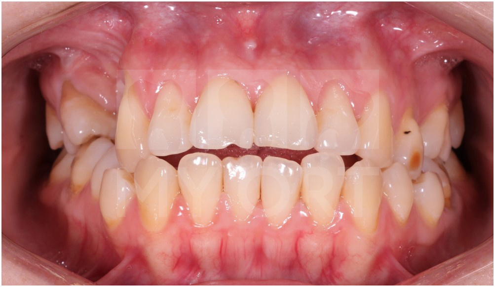 ситуация ДО