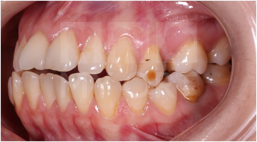 ситуация ДО