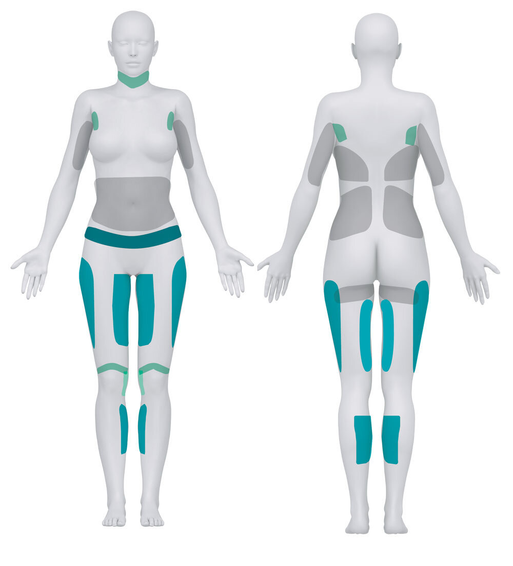 Возможные зоны жировых ловушек