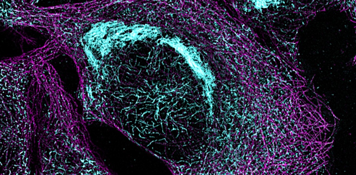Микротрубочки цитоскелета (фиолетовым цветом) и патологические агрегаты тау-белка (голубым) в клеточной модели тауопатии