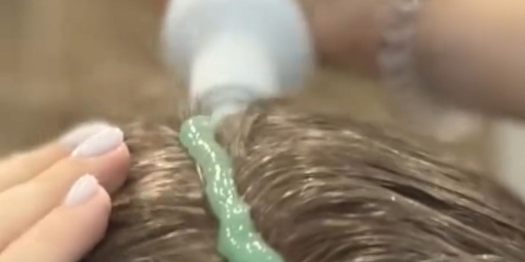 ПЕРХОТЬ | КАК ИЗБАВИТЬСЯ