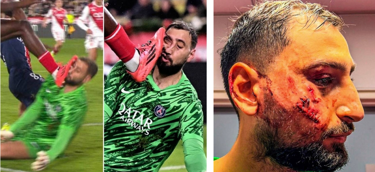 18 декабря. Кошмарный фол, после которого Доннарумма ещё легко отделался