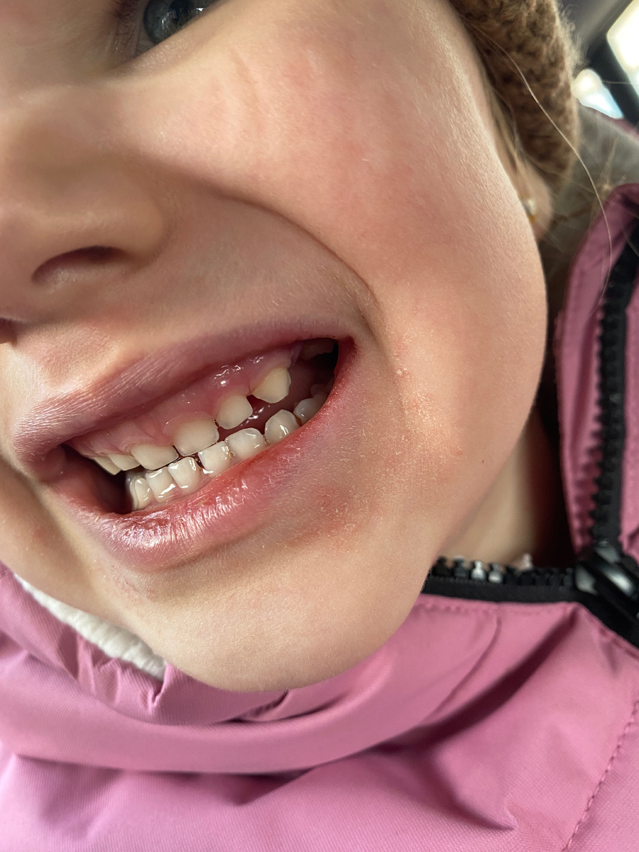 Маленький беззубик