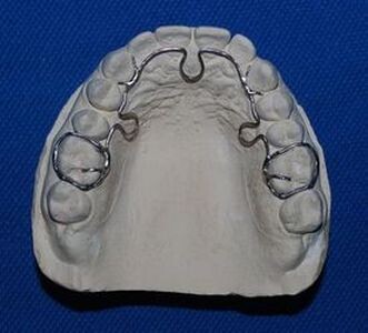 Фото 1: аппарат A.L.F. (Alternative Lightwire Functional Appliances)