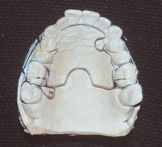 Фото 2: аппарат Crozat