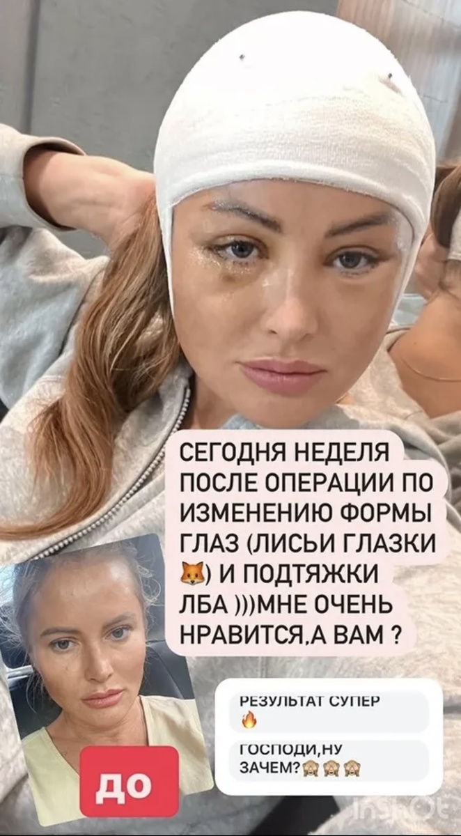-3